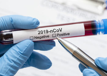 (في سابقة غريبة)- رصد حالة إصابة بكورونا استمرت 613 يوماً..!