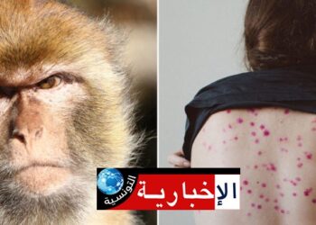 المغرب يسجّل أول إصابة بجدري القرود…