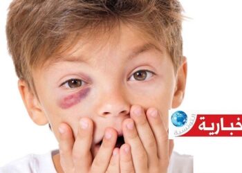 (رقم مفزع)- خلال العيد..إصابة أكثر من 60 طفلا جرّاء ”مسدسات الرشّ”..!