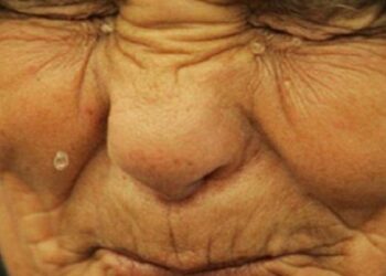 حادثة مروعة: كهل يعنف والدته ويعتدي عليها بطريقة بشعة..