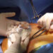 تكبير الصدر: أكثر عمليات التجميل إقبالا في تونس..