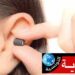 تلميذة باكالوريا تخضع لــ”عملية جراحية” لنزع سمّاعة متطورة لاستعمالها في الغش