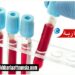 بعد الأربعين..أربعة فحوصات دم هامة تنقذ حياتك..
